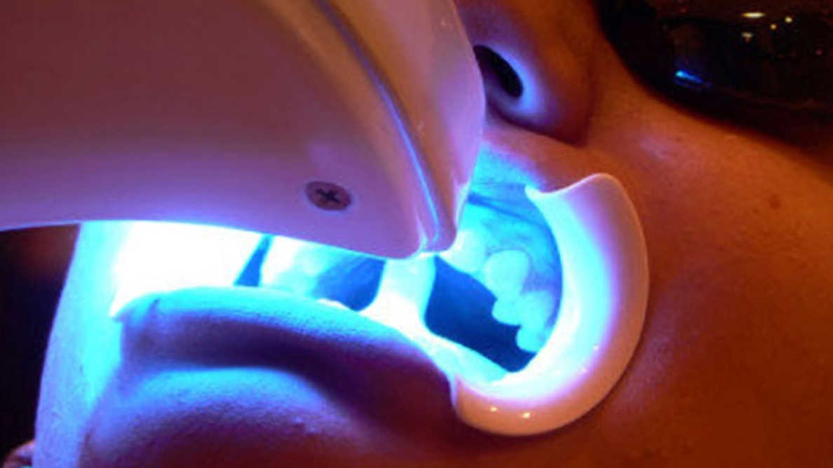Como escolher lâmpada de clareamento dentário