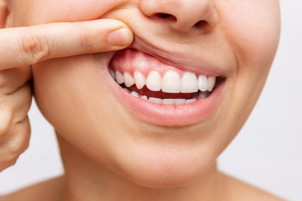 Conheça a estreita relação entre a saúde geral e boca saudável